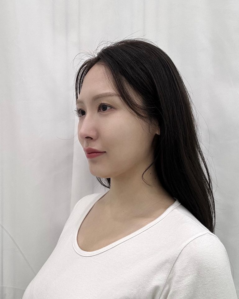 ยุน แชฮวา ภาพขนาดย่อ