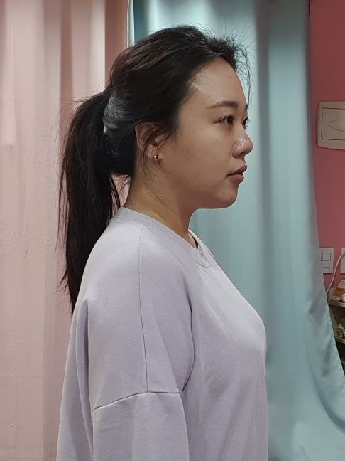 チェ・ユンジョン サムネイル画像