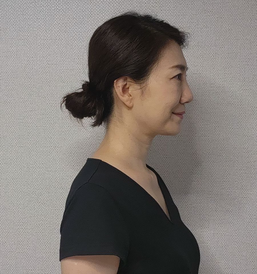 คิม จีอัน ภาพขนาดย่อ