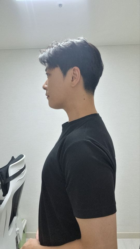 우무곤 ภาพขนาดย่อ