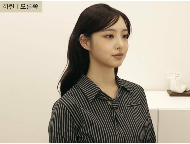 ハリン サムネイル画像