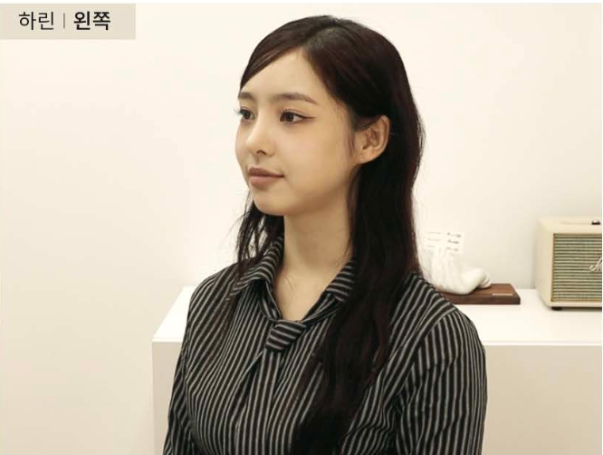 ハリン サムネイル画像