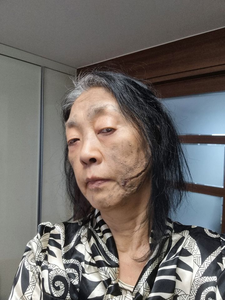 Choe Ji-won Ảnh thu nhỏ