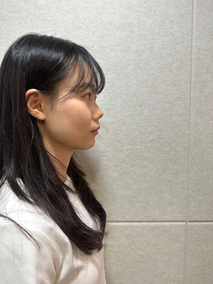 Im Chae-eun Ảnh thu nhỏ