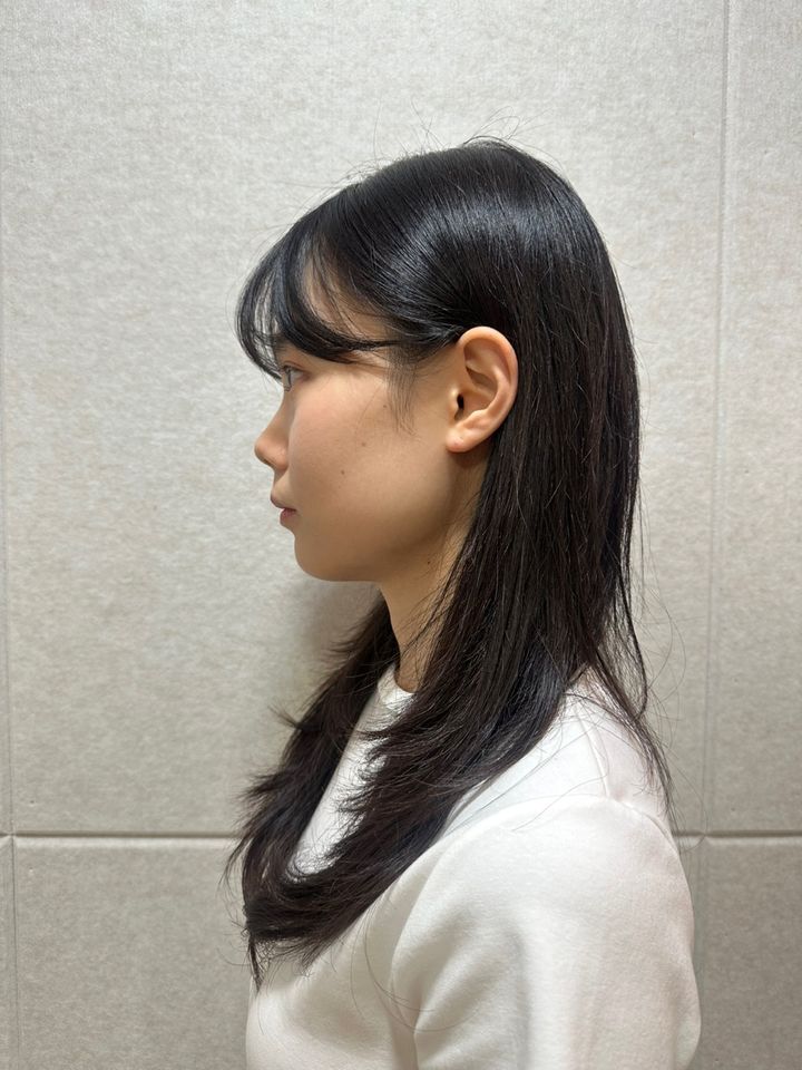 Im Chae-eun Ảnh thu nhỏ